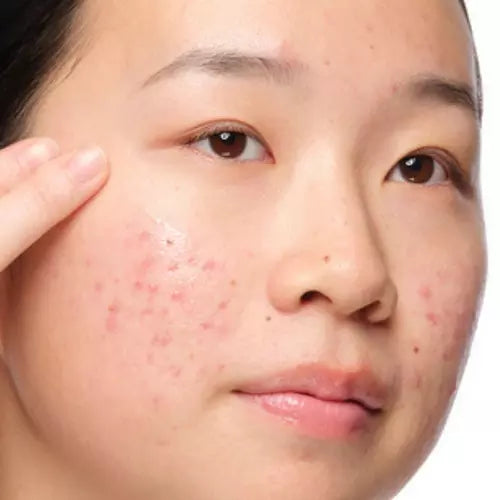 Redness concern